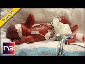 Read more about the article Blessed: The World’s Most Premature Infant To Survive