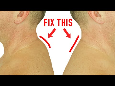 You are currently viewing How to Get Rid of a Neck Hump at Home (Easy Method)