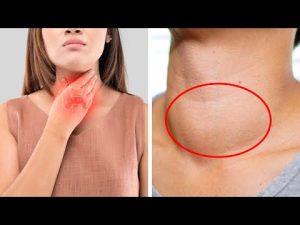 Read more about the article 7 Signs of Thyroid Problems You Should Never Ignore