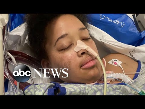 You are currently viewing Pregnant mother fought for her life on a ventilator after getting COVID-19 | Nightline