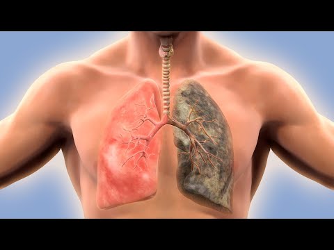 Read more about the article How to Get Back Healthy Lungs After Smoking