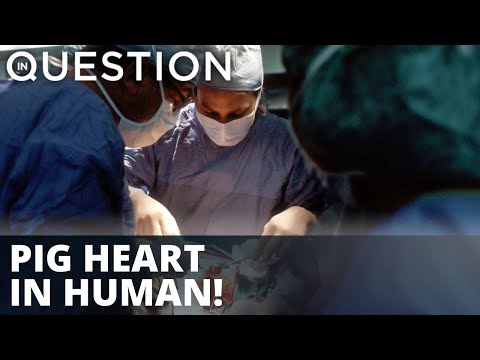 You are currently viewing Maryland doctors transfer pig heart to human patient