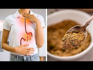 Read more about the article How to Get Rid of Heartburn Without Medication