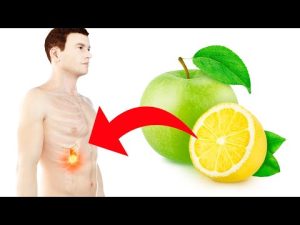 Read more about the article Mix Lemon and Apple and See What Happens To Your Gallbladder