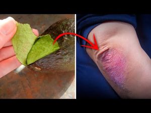 Read more about the article Rub an Avocado Peel On Your Elbow For This Incredible Reason