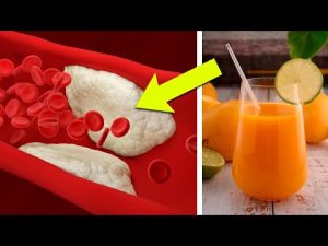 Read more about the article Lower Your Cholesterol With This Powerful Carrot Juice