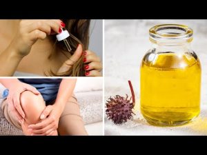 Read more about the article 7 Reasons Why You Need Castor Oil In Your Medicine Cabinet