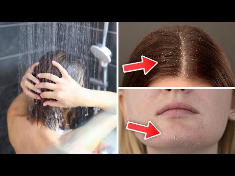 You are currently viewing 8 Surprising Shower Mistakes That Are Hurting Your Skin