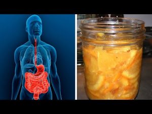 Read more about the article Probiotic Fermented Orange: Improves Intestinal Health and Boosts Immunity