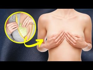 Read more about the article Home Remedies for Breast Infection (Mastitis)