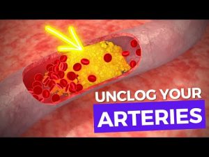 Read more about the article How to Unclog Arteries and Reduce Cholesterol Naturally