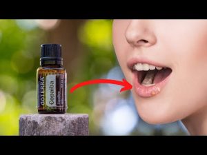 Read more about the article Copaiba: Powerful Remedy for Herpes, Eczema, Syphilis, and Even Stroke