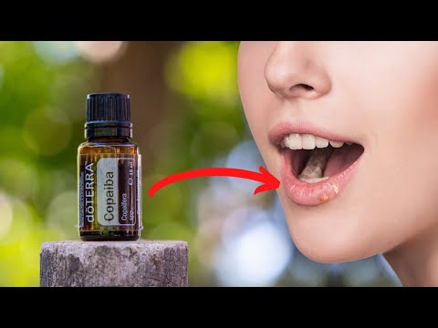 You are currently viewing Copaiba: Powerful Remedy for Herpes, Eczema, Syphilis, and Even Stroke