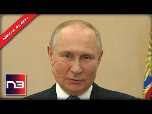 Read more about the article People Noticed That Putin Had Dark Splotches On His Cheeks, Here’s What It Could Be