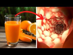 Read more about the article How to Clean Your Stomach and Intestines Naturally