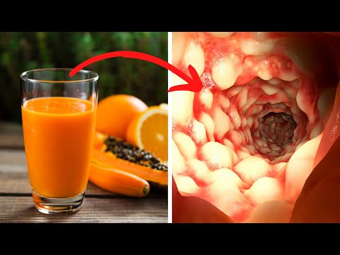 You are currently viewing How to Clean Your Stomach and Intestines Naturally