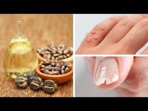 Read more about the article Few People Know These Surprising Castor Oil Uses