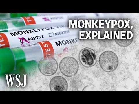 Read more about the article What to Know About the Monkeypox Outbreak | WSJ