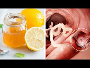 Read more about the article Mix Lemon Peel With Honey To Eliminate Intestinal Worms