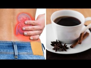 Read more about the article Star Anise Coffee: A Natural And Effective Treatment For Kidney Stones