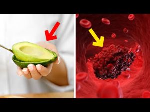 Read more about the article Eat These Foods To Prevent Blood Clots, Heart Attacks And Strokes