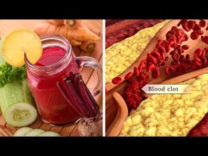 Read more about the article Drink A Glass Of This Juice Every Morning To Cleanse Your Arteries