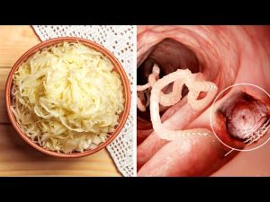 Read more about the article Eat These Foods To Sweep Parasites Out of Your Intestines