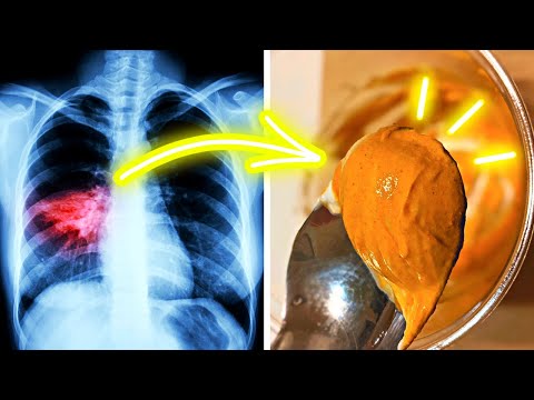 You are currently viewing Turmeric Jelly: A Miraculous Remedy To Treat Respiratory Diseases