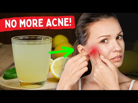 Read more about the article Drinking This Juice Daily Can Rid Your Skin of Pimples and Blemishes