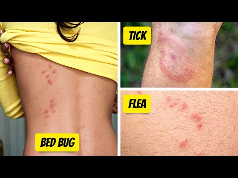 Read more about the article What Bit Me? How To Identify The Most Common Bug Bites