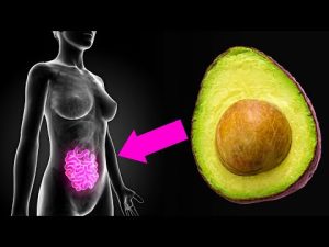 Read more about the article A Surprising Reason To Eat More Avocados