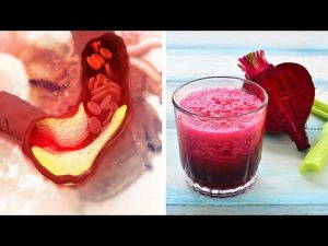 Read more about the article Drink This Juice To Purify The Blood And Clean The Arteries