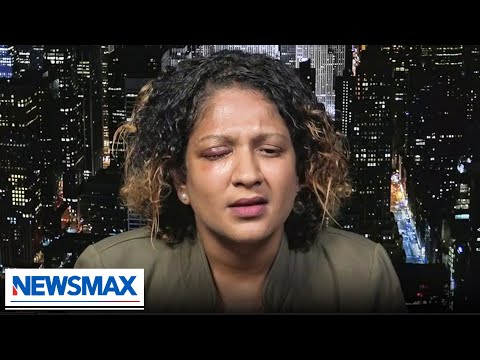 You are currently viewing NYC subway attack victim speaks out with message to liberal leaders