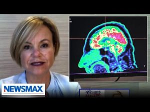 Read more about the article Neurologist: This new drug could slow down Alzheimer’s | Dr. Teryn Clarke