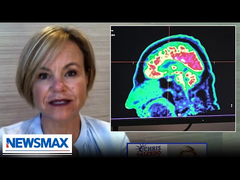 You are currently viewing Neurologist: This new drug could slow down Alzheimer’s | Dr. Teryn Clarke