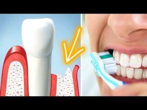 Read more about the article This Bad Habit May Be Causing Your Gums To Recede