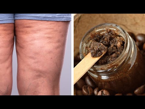 Read more about the article Get Rid of Cellulite and Stretch Marks with this Homemade Coffee Body Scrub!