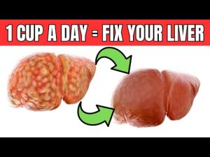 Read more about the article Drinking 1 Cup of THIS Fixes Fatty Liver in 2 WEEKS!