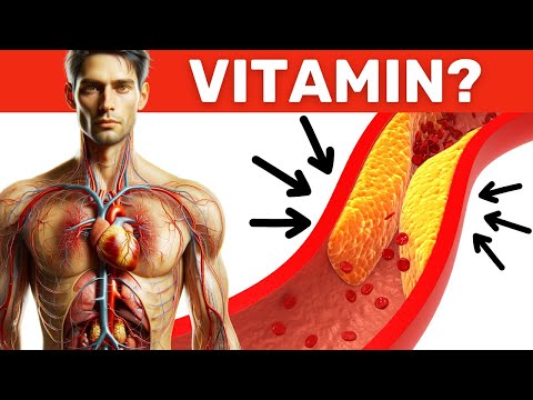 Read more about the article #1 VITAMIN to remove PLAQUE and BAD CHOLESTEROL from ARTERIES